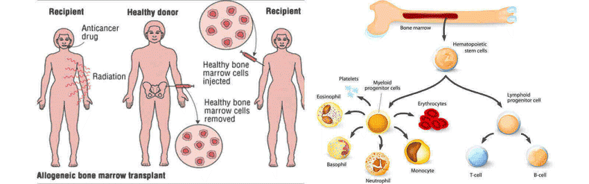 bone marrow transplant procedure in india