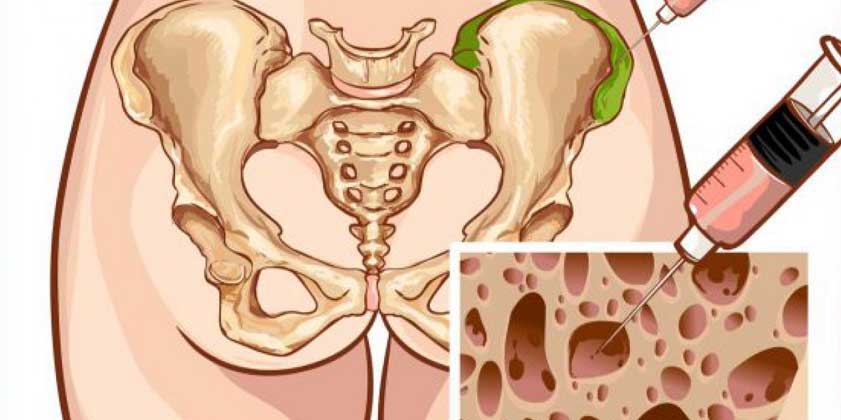 bone marrow transplantation types in india