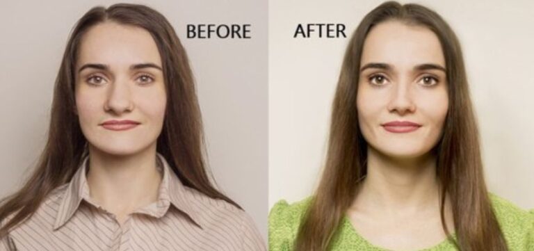 Plastic Surgery Cost In India Cost In India From Best Doctor   Plastic Surgery Treatment Cost 768x361 