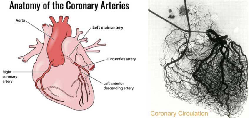 angiography test in india