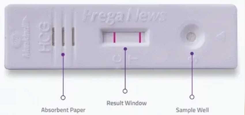 prega news kit