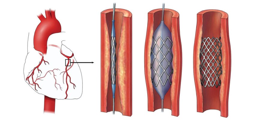 Concerns Before to and After Surgery