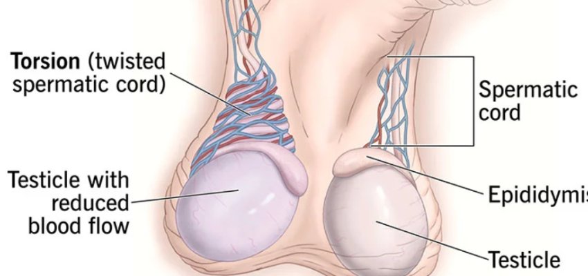 Networks for the Illicit Trade in Organs