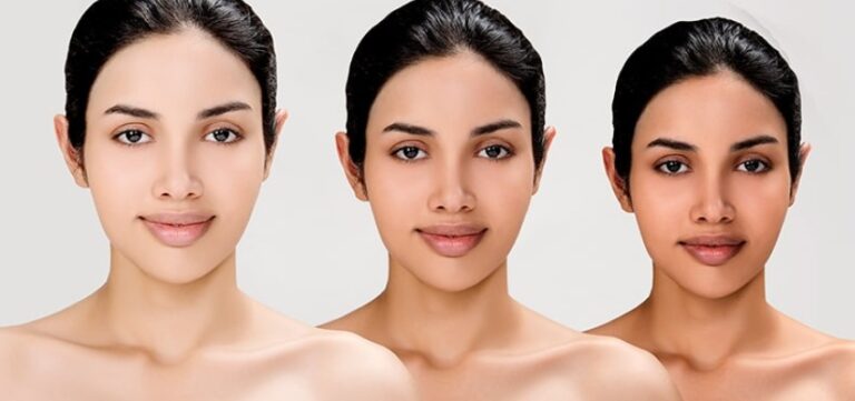 Skin Whitening Treatment Cost In India Cost In India From Best Doctor