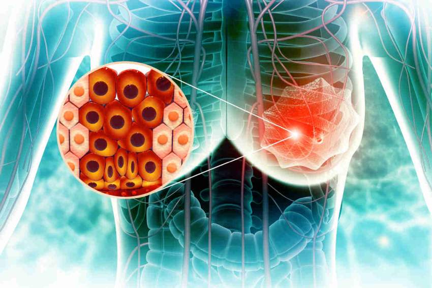 Diagnosis of targeted therapy