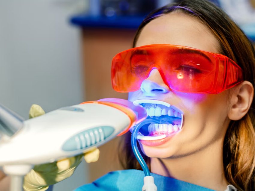 Diagnosis of teeth whitening treatment