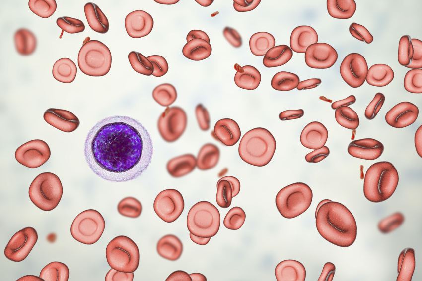 Prognosis of Aplastic Anemia