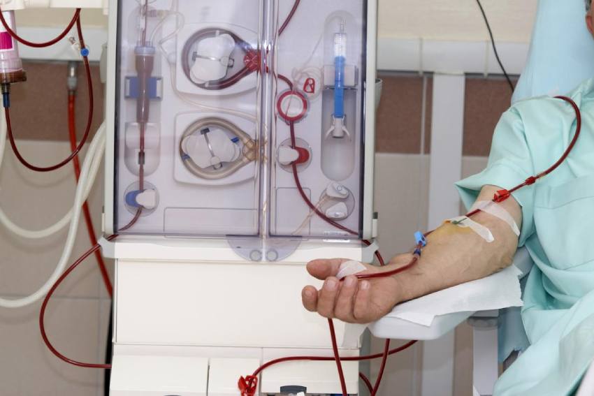 Side effects of Dialysis Treatment