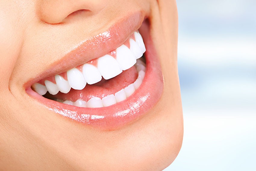 Teeth whitening treatment outlook