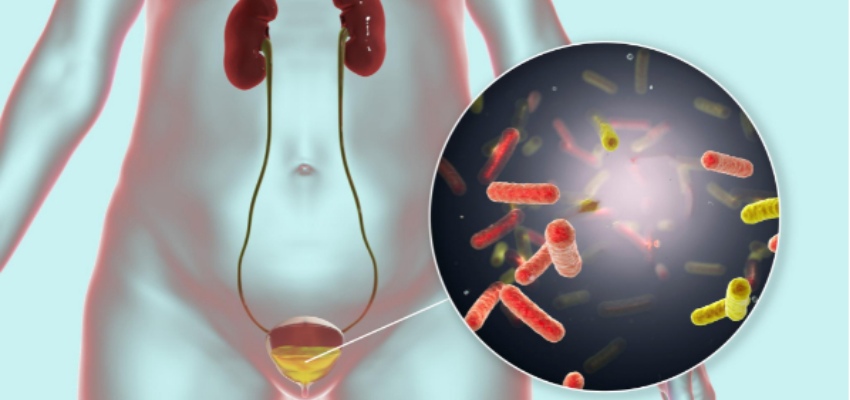सिस्टाइटिस-से-बचाव
