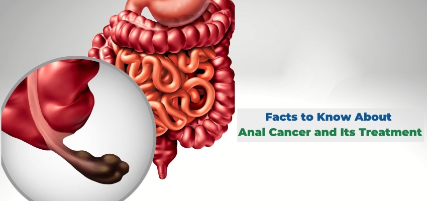 Introduction Anal Cancer Treatment