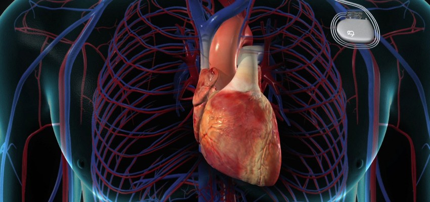 About Cardiac Ablation