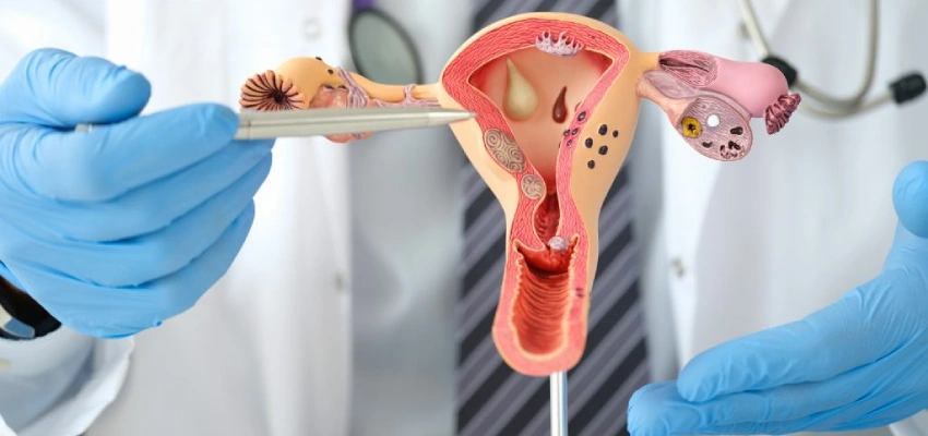 About-Endometrial-Cancer-Treatment