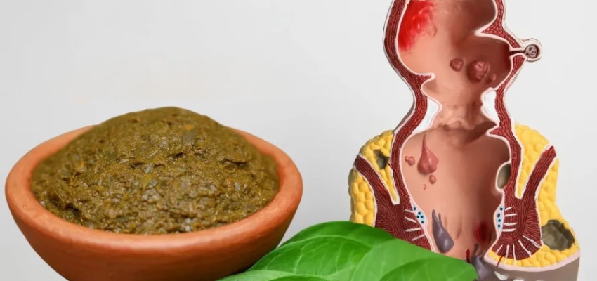 Bavaseer-ke-masse-sukhane-ki-ayurvedic-dawa