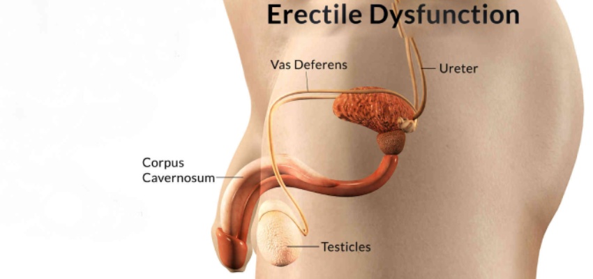 Diagnosis-of-erectile-dysfunction