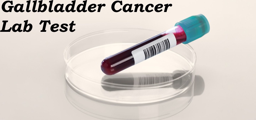 Lab-test-Gallbladder-Cancer