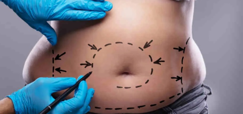 Cosmetic Surgery in Bangalore