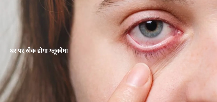 Ghar par Glaucoma thik karne ke tarike