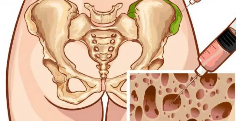 bone marrow transplantation types in india