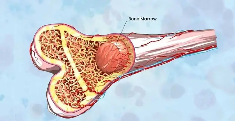 bone marrow transplantation risk