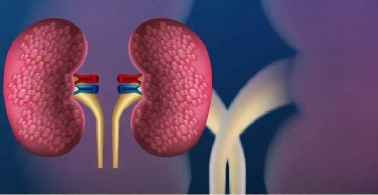 types of kidney transplants