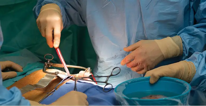 Treatment of kidney transplant