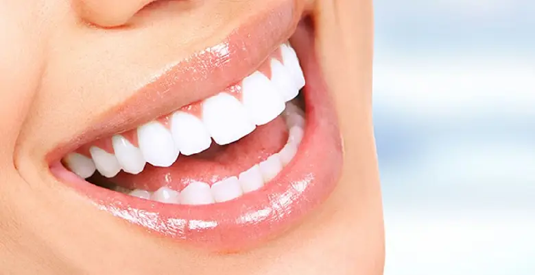 Treatment of Teeth Whitening