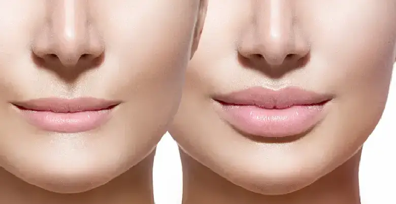 lips surgery procedure 