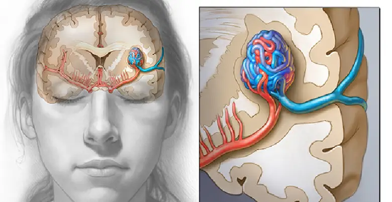 Advantages and disadvantages of treatment