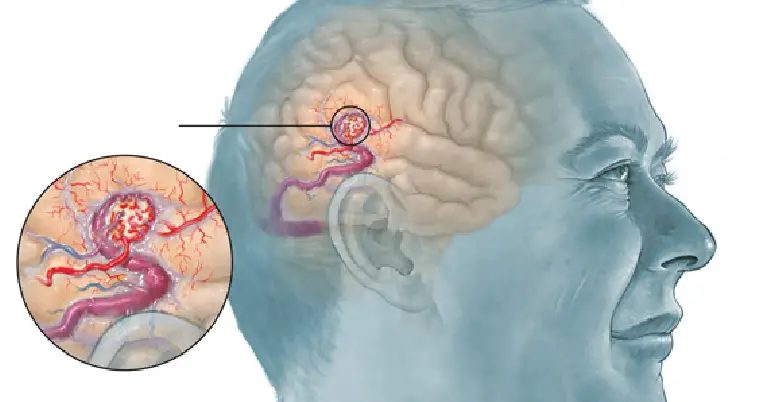 Advanced therapies