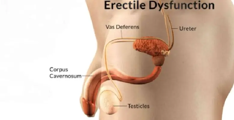 Prognosis of erectile dysfunction