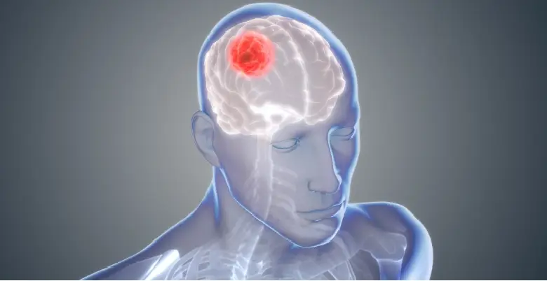 Introduction Glioblastoma Treatment