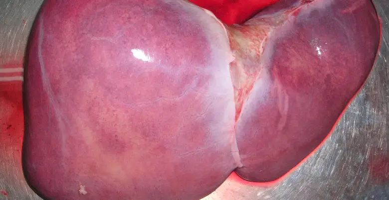 Treatment of Liver Transplant