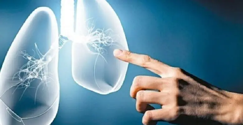 Diagnosis of lung cancer