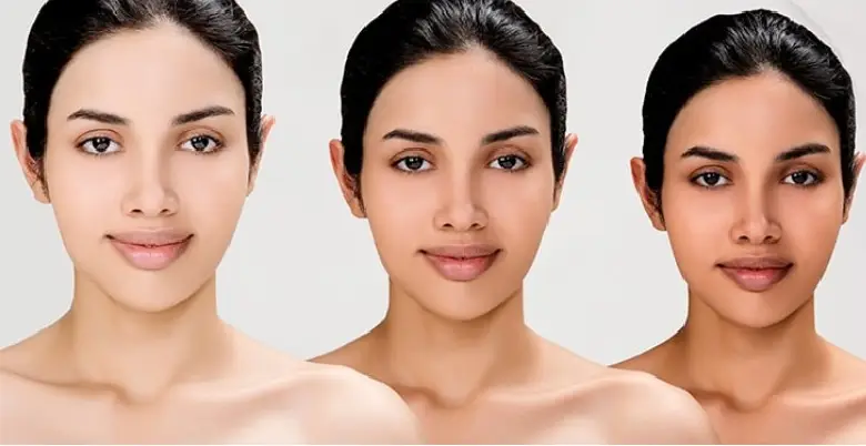 Skin Whitening Treatment Introduction