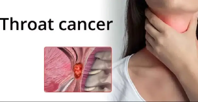 Throat cancer types