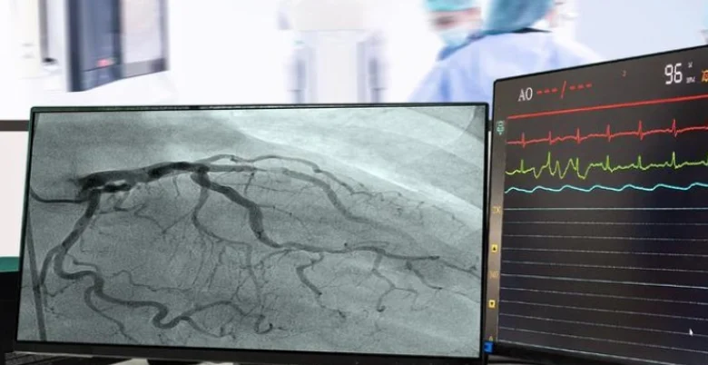 Angiography or Angiogram or Angioplast kase kamm karte ho 