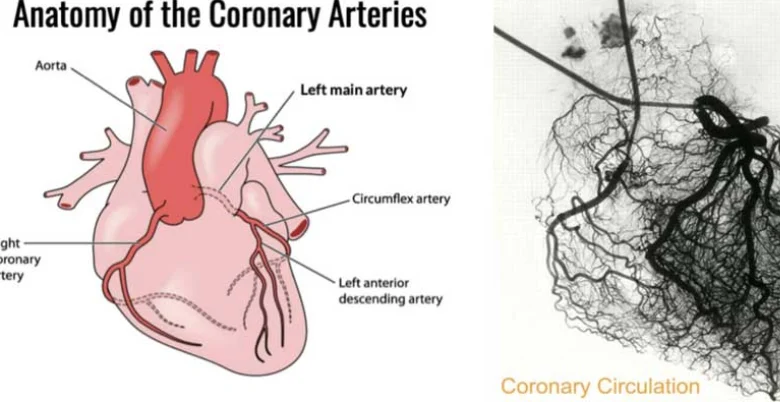 Angiography kya hai 