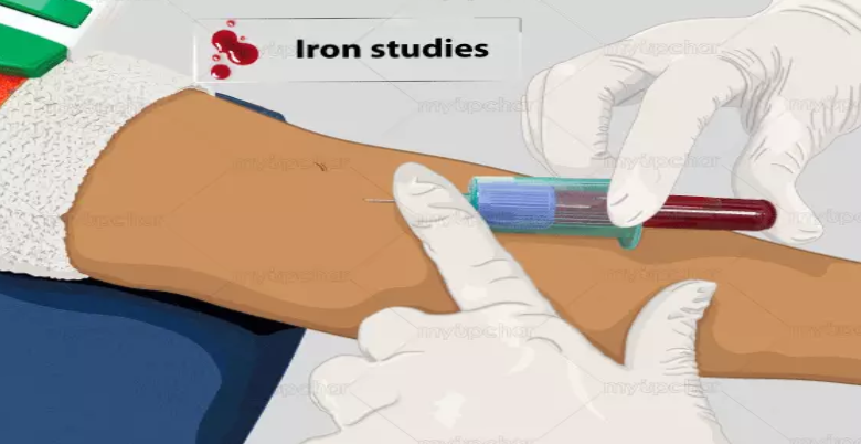 Get prepared for iron studies with these tips.