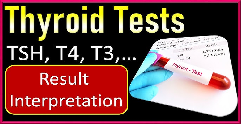 Results and reports of Thyroid profiling tests.