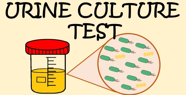 Procedure of urine culture test.