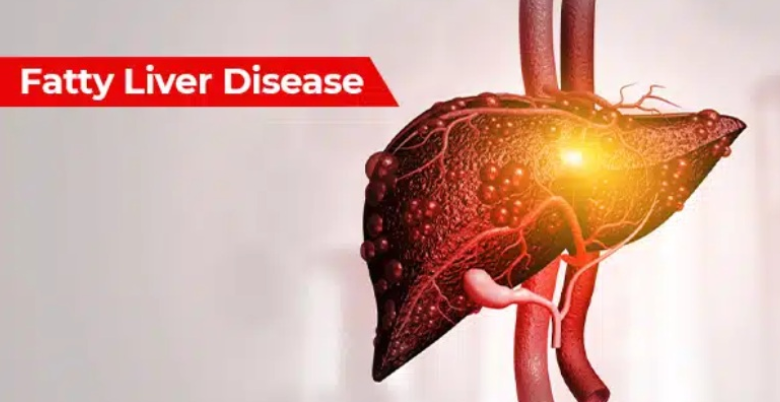 Fatty Liver ke Ayurveda tips 